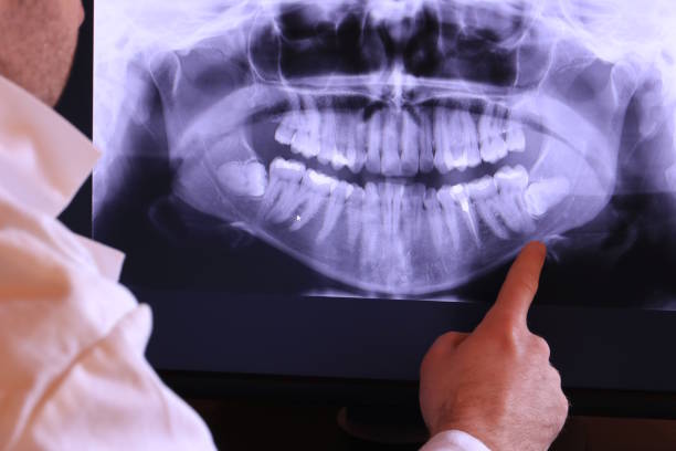 Best Broken or Cracked Tooth Emergency Dentist in Chamberlain, SD